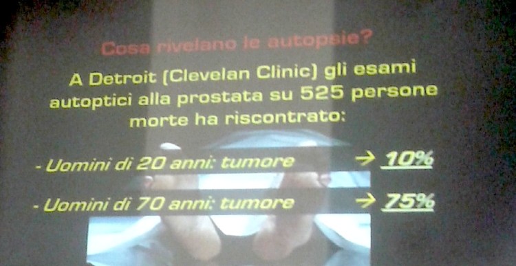 Rilevazione tumori autopsie Detroit