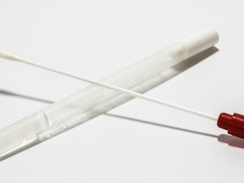 Ancora tamponi negli&nbsp;ospedali!